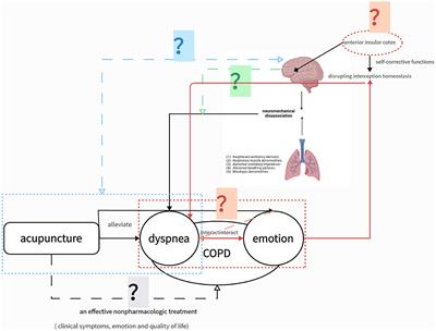 Efficacy and cerebral mechanisms of acupuncture for chronic obstructive pulmonary disease: study protocol for a multicenter, randomized controlled neuroimaging trial